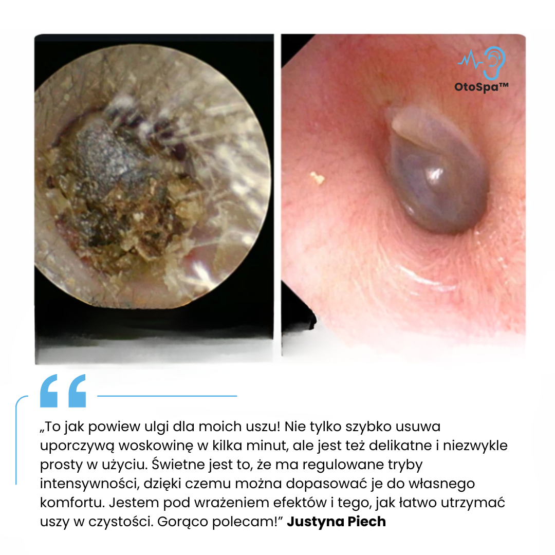 OtoSpa™ Domowy Irygator Do Czyszczenia Uszu
